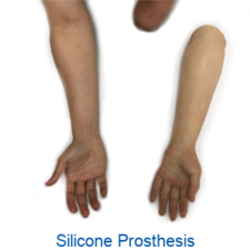 Authentic silicone prosthetic hand & silicone foot